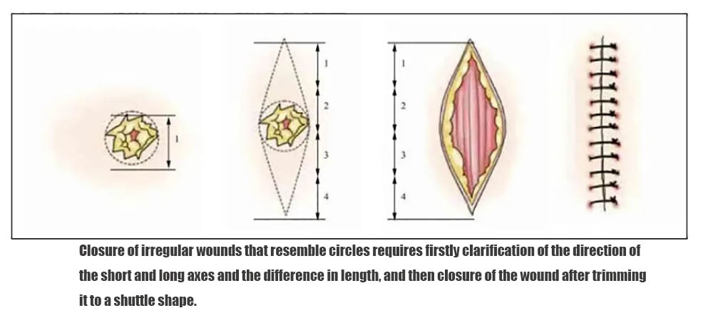 Circular irregular wounds