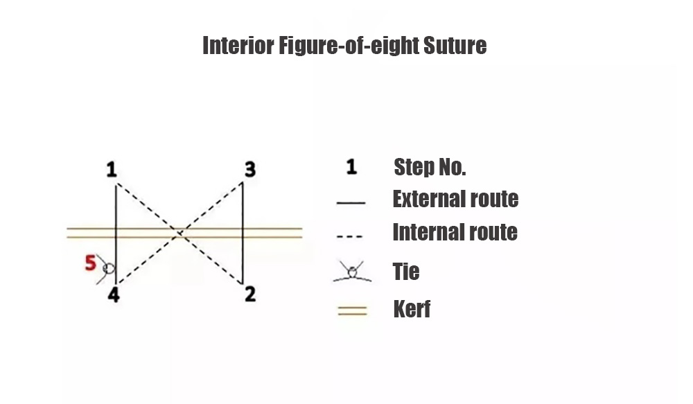 Interior Figure-of-eight Suture