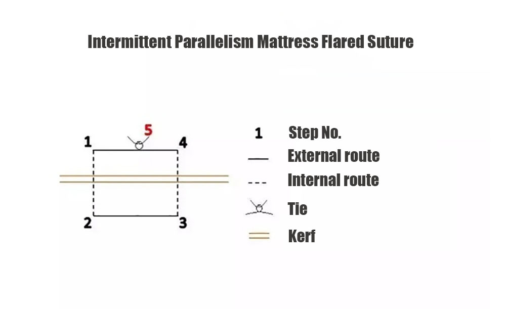 Intermittent Parallelism Mattress Flared Suture