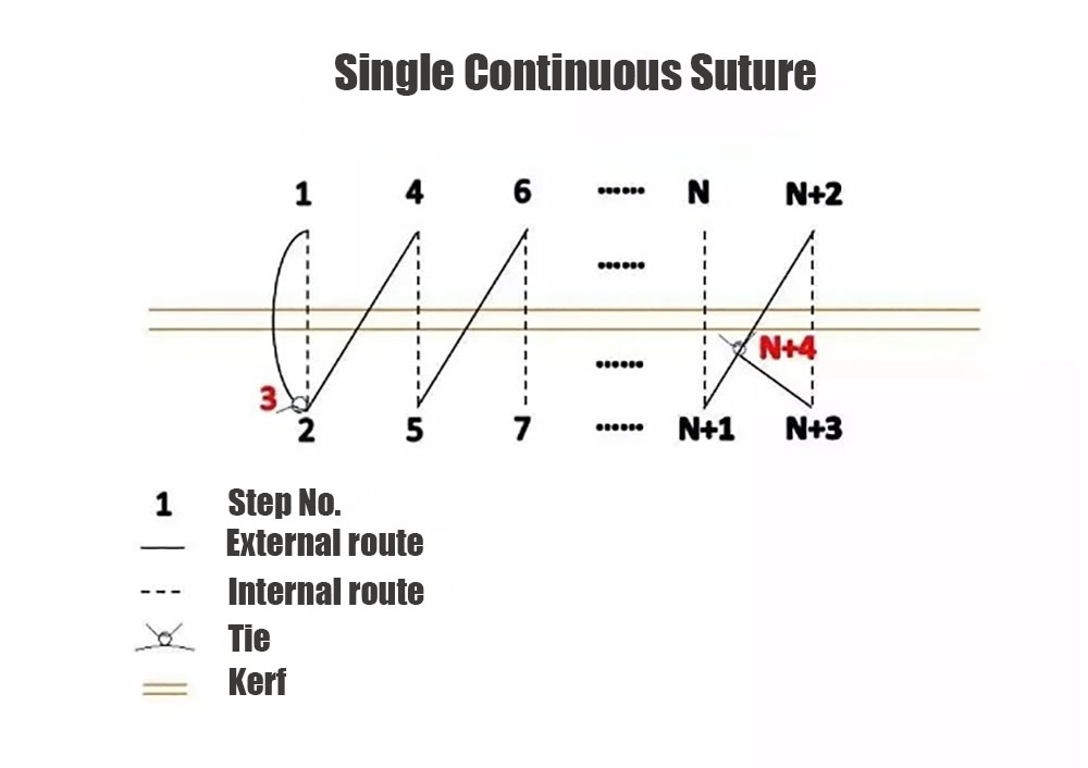 Single Continuous Suture