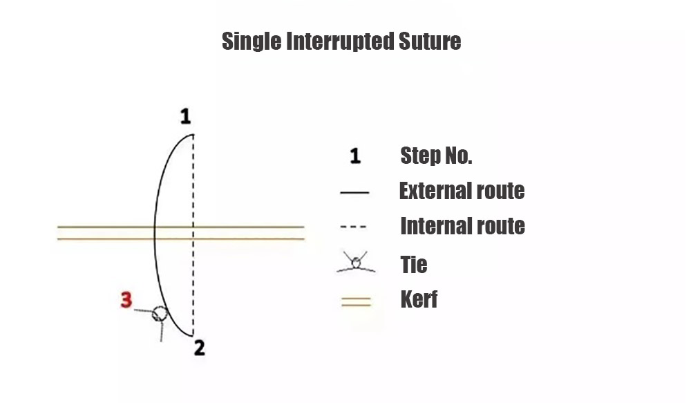 Single Interrupted Suture-2