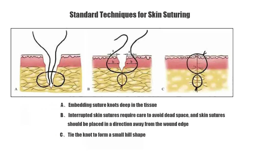 Standard Techniques for Skin Suturing