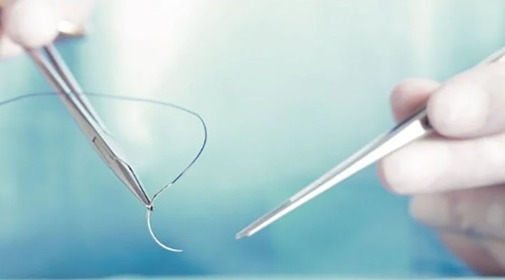 different types of surgical sutures​-4